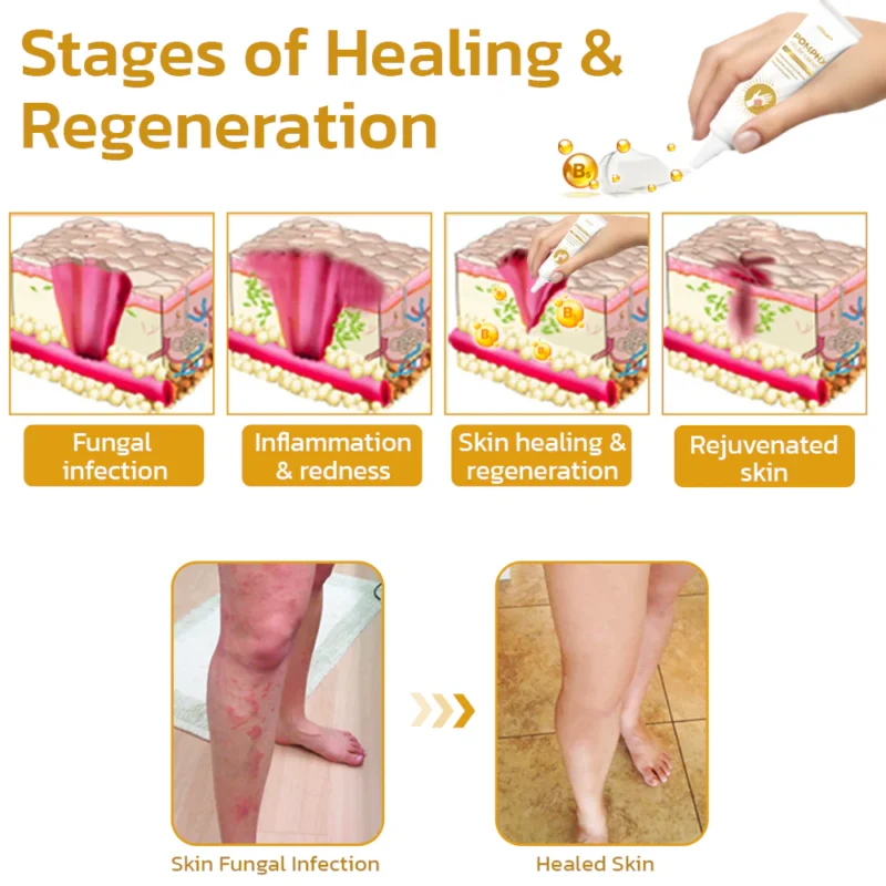 GFOUK™ PomphX Relief Cream