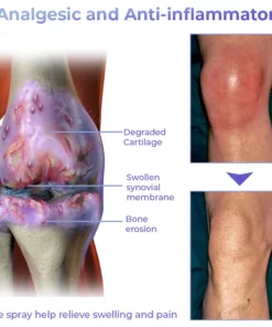 GFOUK™ Pro PainRelief Restorative Joint Spray