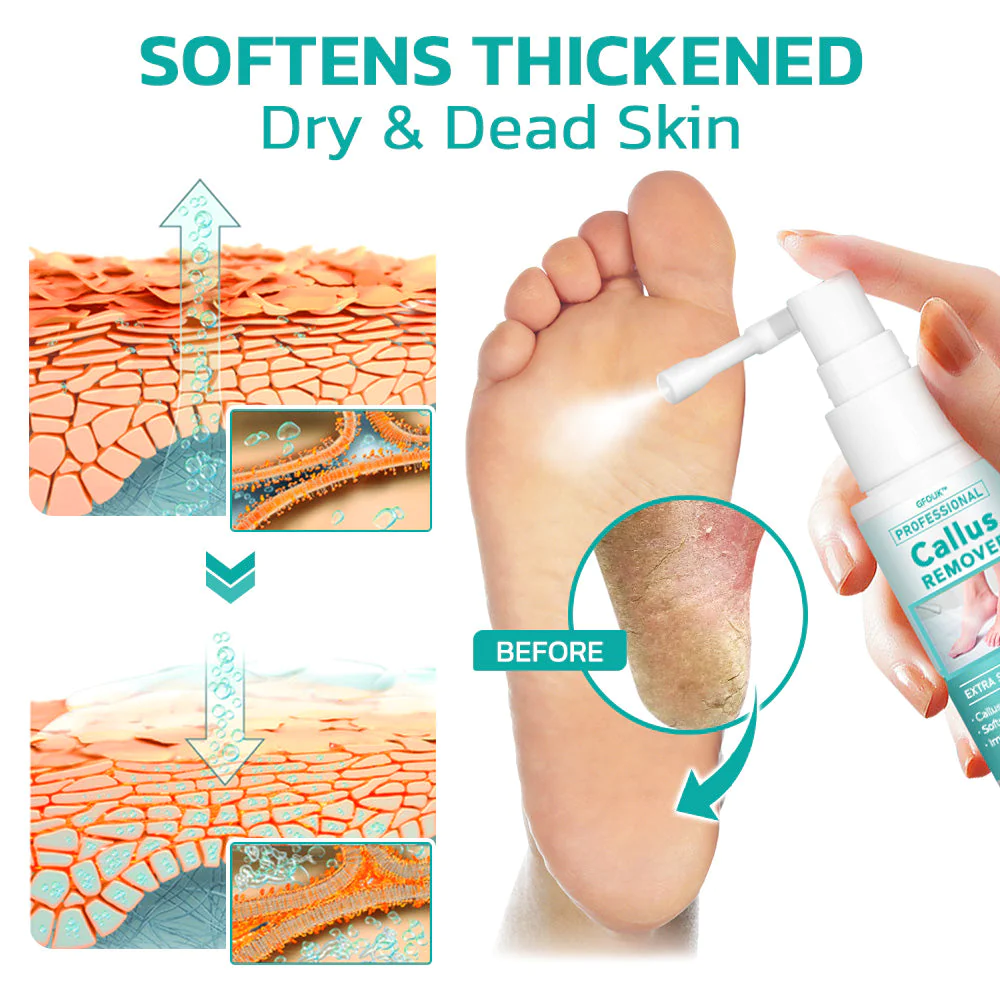 Extra dead sales skin on feet