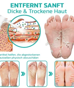 GFOUK™ Professioneller Hornhautentferner Extra Strength Spray