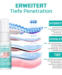 GFOUK™ Professioneller Hornhautentferner Extra Strength Spray