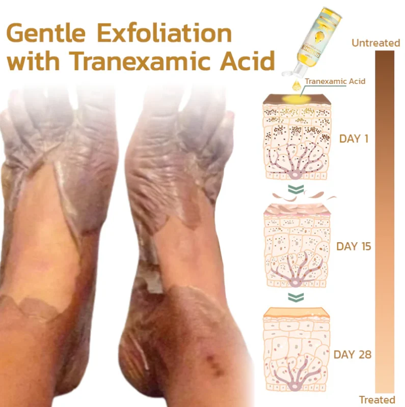 GFOUK™ Retone Acanthosis Oil