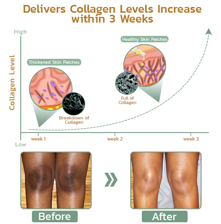 GFOUK™ Retone Acanthosis Oil