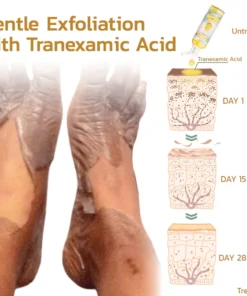 GFOUK™ Retone Acanthosis Oil