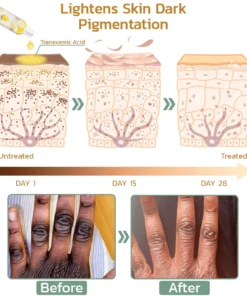 GFOUK™ Retone Acanthosis Oil
