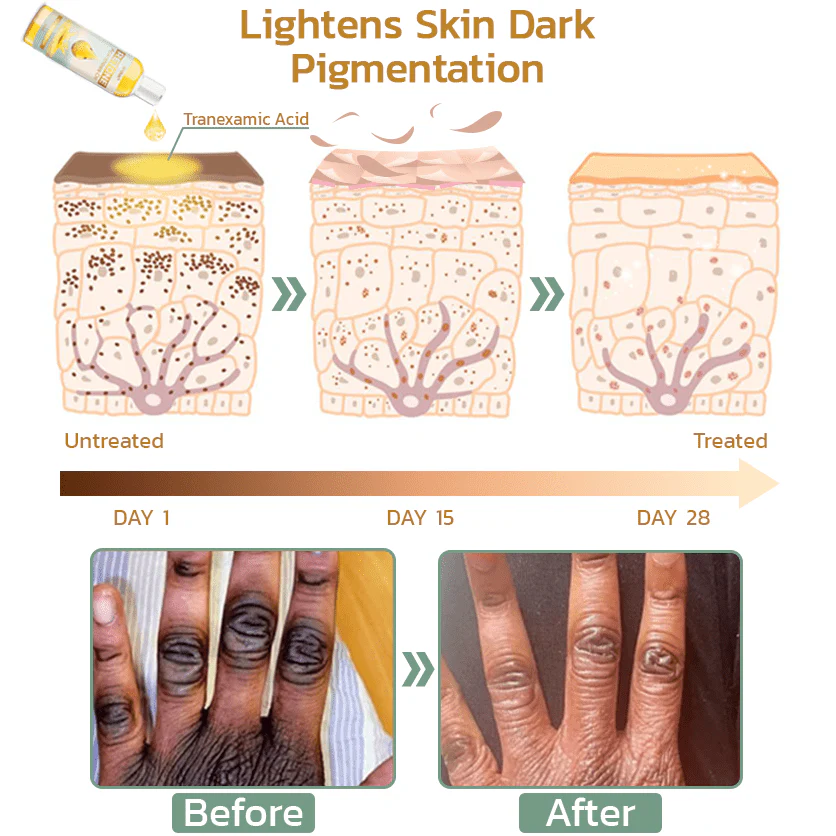 GFOUK™ Retone Acanthosis Oil