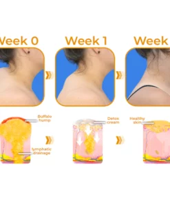 GFOUK™ Sculpting Lymphatic Drainage Detox Cream