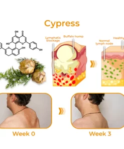 GFOUK™ Sculpting Lymphatic Drainage Detox Cream