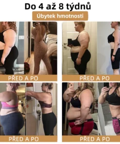 GGPM™ Včelí Jed Lymfatická Drenážní Redukční Náplast