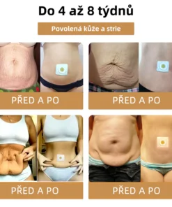 GGPM™ Včelí Jed Lymfatická Drenážní Redukční Náplast