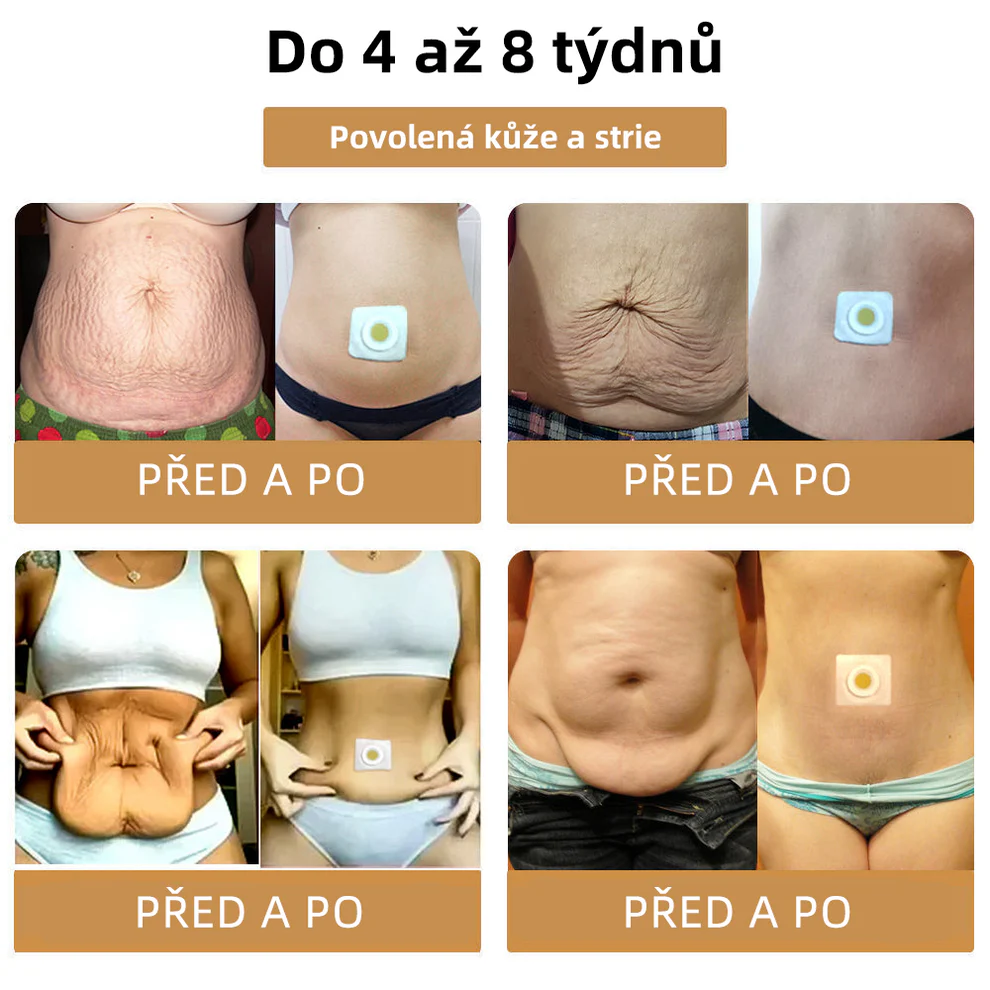 GGPM™ Včelí Jed Lymfatická Drenážní Redukční Náplast