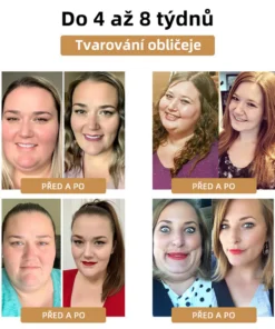 GGPM™ Včelí Jed Lymfatická Drenážní Redukční Náplast