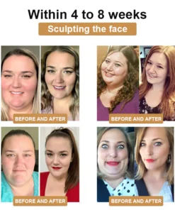 GGPM™ 𝐁𝐞𝐞 𝐕𝐞𝐧𝐨𝐦 𝐋𝐲𝐦𝐩𝐡𝐚𝐭𝐢𝐜 𝐃𝐫𝐚𝐢𝐧𝐚𝐠𝐞 𝐒𝐥𝐢𝐦𝐦𝐢𝐧𝐠 𝐏𝐚𝐭𝐜𝐡