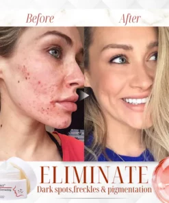 GLODIANT™ Pigment Correcting Cream