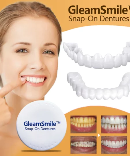 GleamSmile™ Snap-On Dentures