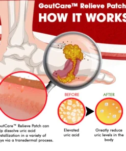 GoutCare™ Relieve Patch