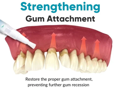 HZA™ Gum Shield Therapy Gel