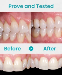 HZA™ Gum Shield Therapy Gel