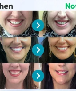 HZA™ Gum Shield Therapy Gel