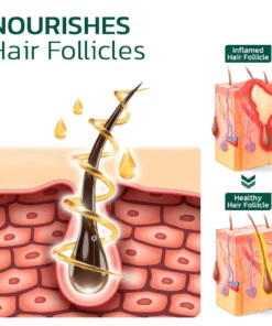 Alternative view of HairVive™ Scalp Folliculitis Therapy Oil
