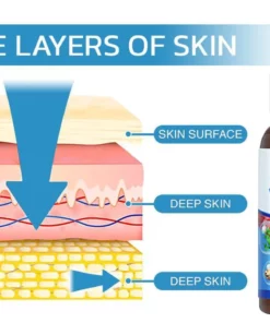 HealthX™ Varicose Veins Spray