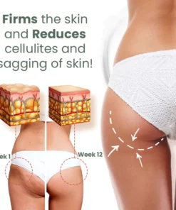 HealthX™ Wormwood CelluliteBeGone Skin Tighten Cream