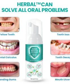 Herbal TEETHClean Mouthwash - Solve all Oral Problems