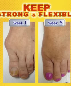 Humxf™ Joint & Bone Therapy Bee Venom Treatment Gel