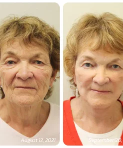 Humxf™ Snail Mucin Multi-Peptide Advanced Repair Cream