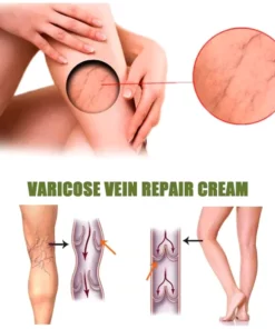 Humxf™ Varicose Veins Spray