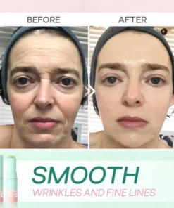 Hyperlift™ Wrinkle Fix Balm