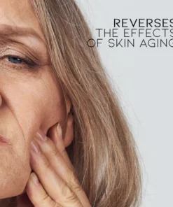 Alternative view of InstaLift Koreanisches Protein-Fadenlifting-Set