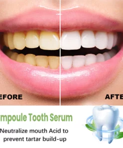 IvoryAm™ Tartar Removal & Tooth Whitening Serum