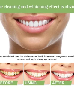 IvoryAm™ Tartar Removal & Tooth Whitening Serum