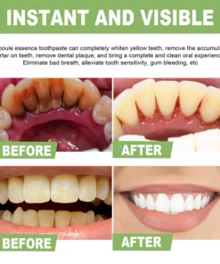 IvoryAm™ Tartar Removal & Tooth Whitening Serum