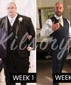 KILOSY Electrostatic Agate LeatherBeads Band