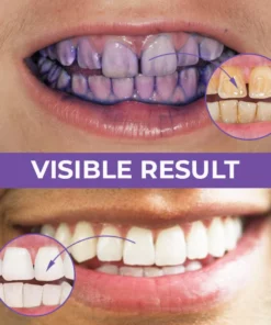 KK™ Deluxe Herbal Teeth Whitening Mousse