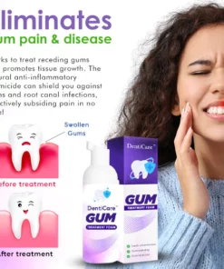 KK™ Gum Treatment Foam