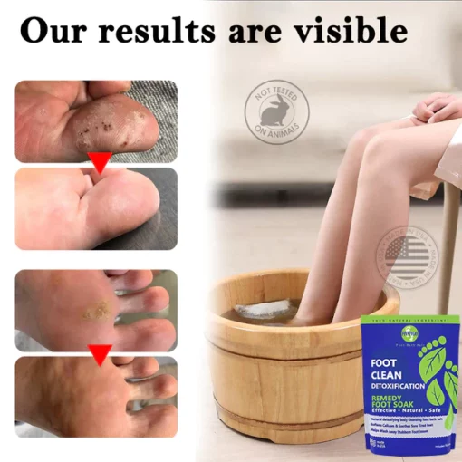 KK™ Herbal Detox Cleansing Foot Care Pack - Image 3