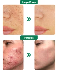 Alternative view of KK™ TRULYMI Green Tea Vitamin Detox Mask