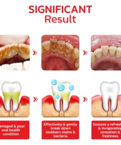 KK™️ SP4 Probiotic Whitening Toothpaste