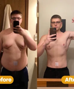 LIMETOW™ Bee Venom Slimming Patch