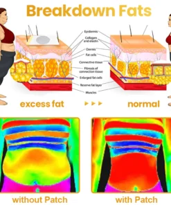 LIMETOW™ Bee Venom Slimming Patch