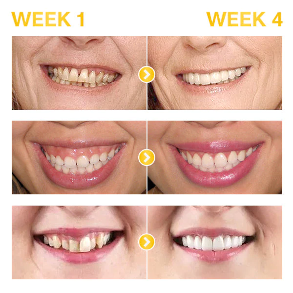 Liacsy™ 7 Days ProActive Gum Treatment - Image 4