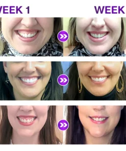 Liacsy™ GingivaWhite Gum Corrector