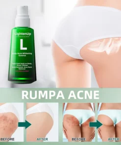 Alternative view of LightenUp™ Body Acne Serum