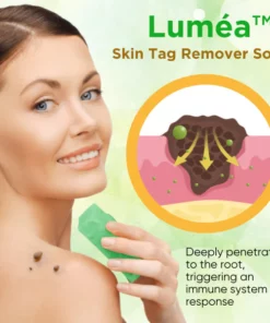 Alternative view of Luméa™ Skin Tag Remover Soap