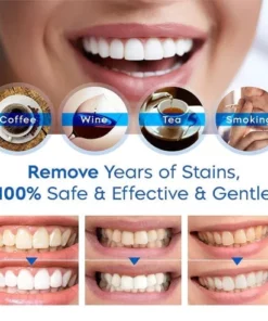 Alternative view of LuminSmile™ Teeth Whitening Essence