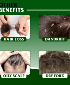 LunaLoom™ HairRebirth Herbal Rehu