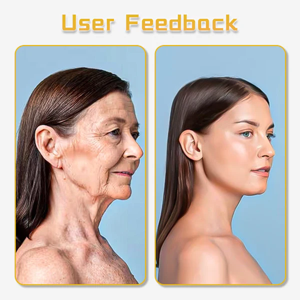 Dispositivo de estiramento facial ultrasónico LunaLoom™ UltraRenew